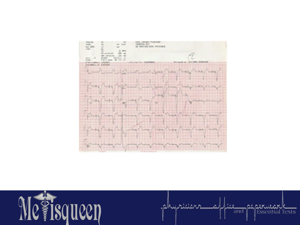 Sims 3 — Patient EKG by metisqueen2 — Patient EKG to clutter your clinic desk; Stackable