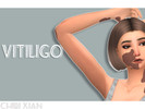 Sims 4 — Chibi Xian - Vitiligo by TheSimGirl0112 — simply patchy skin vitiligo Found under skin details 