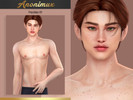 Sims 4 — Freckles 01 by Anonimux_Simmer — - 3 Swatches - Male/Female - All ages - Moles category - BGC - HQ - Thanks to