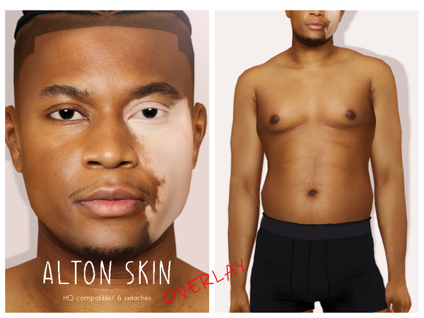 Sims 4 — [Patreon] Alton Skin Overlay by thisisthem —  HQ Compatible ; Overlay (6 swatches) ; Skin Details Category ;