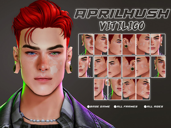 Sims 4 — [aprilhush] vitiligo by aprilhush — 8 vitiligo variants