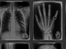 Sims 4 — YK X-Ray Collection: Fractures and Injuries by ostafijchukzhenya — A collection of stylized X-ray images